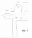 Fig. 02 - Shape-memory polymer foam device for treating aneurysms