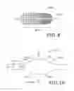 Fig. 09 - Shape-memory polymer foam device for treating aneurysms