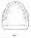 Fig. 02 - Method of making a denture with nature bite and wear properties and denture