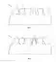 Fig. 02 - Dental prosthesis and moulding method