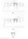 Fig. 04 - Dental prosthesis and moulding method