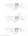 Fig. 07 - Dental prosthesis and moulding method