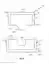 Fig. 08 - Dental prosthesis and moulding method