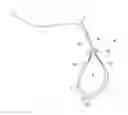 Fig. 01 - Adjustable suture button construct