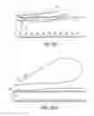 Fig. 06 - Adjustable suture button construct