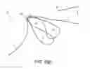 Fig. 08 - Adjustable suture button construct