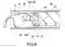 Fig. 06 - Intraocular lens insertion device