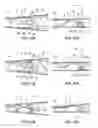 Fig. 07 - Intraocular lens insertion device