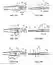 Fig. 09 - Intraocular lens insertion device