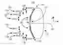 Fig. 01 - Adjusting the apodization pattern for diffractive IOLs