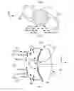 Fig. 02 - Adjusting the apodization pattern for diffractive IOLs