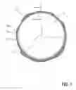 Fig. 02 - Heart valve prosthesis for controlled thrombus development