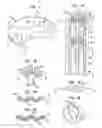 Fig. 02 - Apparatus and method for heart valve repair