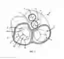 Fig. 02 - Annuloplasty repair devices, systems and methods