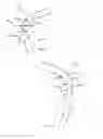 Fig. 07 - Annuloplasty repair devices, systems and methods