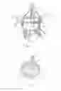 Fig. 09 - Annuloplasty repair devices, systems and methods