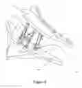 Fig. 06 - Electronically controlled artificial intervertebral disc with motor assisted actuation systems