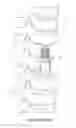 Fig. 02 - METHOD OF IMPLANTING A CORPECTOMY CAGE