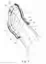 Fig. 03 - Profile for the attachment of an immobilisation mask