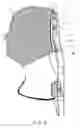 Fig. 05 - Profile for the attachment of an immobilisation mask