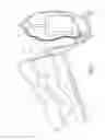 Fig. 02 - ACTIVE HEAD-SHOULDER AND TORSO POSITIONING DEVICE FOR ENDOTRACHEAL INTUBATION