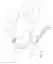 Fig. 07 - Enhanced flexibility neurovascular catheter