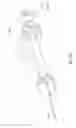 Fig. 31 - Enhanced flexibility neurovascular catheter