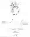 Fig. 40 - Enhanced flexibility neurovascular catheter