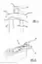 Fig. 06 - MAGNETIC GUIDANCE SYSTEM PARTICULARLY FOR NEUROLOGICAL DEVICE