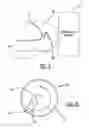 Fig. 07 - MAGNETIC GUIDANCE SYSTEM PARTICULARLY FOR NEUROLOGICAL DEVICE
