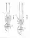 Fig. 06 - Medical device including an actuator restraining assembly
