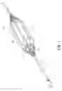 Fig. 02 - Perfusion balloon with internal valve