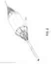 Fig. 03 - Perfusion balloon with external valve