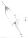 Fig. 04 - Perfusion balloon with external valve