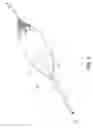 Fig. 06 - Perfusion balloon with external valve