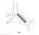 Fig. 07 - TOOL HUB AND ACCESS POINT AND METHOD