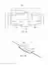 Fig. 04 - Trigeminal neurostimulation based upon pulse counting and chronobiology