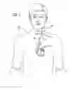 Fig. 02 - Flexible circuit peripheral nerve stimulator with low profile hybrid assembly