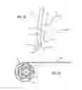 Fig. 03 - Flexible circuit peripheral nerve stimulator with low profile hybrid assembly