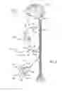 Fig. 04 - Flexible circuit peripheral nerve stimulator with low profile hybrid assembly