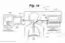 Fig. 02 - Electrical stimulation for preservation and restoration of diaphragm function