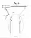 Fig. 03 - Electrical stimulation for preservation and restoration of diaphragm function