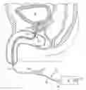 Fig. 01 - Urethral catheters and methods for facilitated introduction into the urinary tract