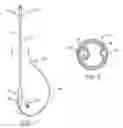 Fig. 02 - Urethral catheters and methods for facilitated introduction into the urinary tract
