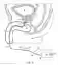 Fig. 05 - Urethral catheters and methods for facilitated introduction into the urinary tract