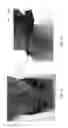 Fig. 07 - Transdermal electrical stimulation at the neck to induce neuromodulation