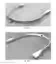 Fig. 09 - Transdermal electrical stimulation at the neck to induce neuromodulation