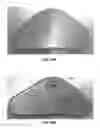 Fig. 41 - Transdermal electrical stimulation at the neck to induce neuromodulation