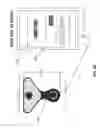 Fig. 49 - Transdermal electrical stimulation at the neck to induce neuromodulation