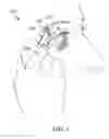Fig. 04 - Stimulation patterns for treating dry eye